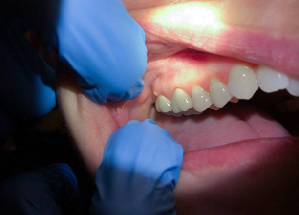 Best Weekend Emergency Dentist in Mounds View, MN